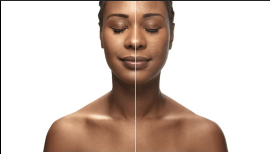 5 Reasons Why Your Skin Needs a Glazing Milk Moisturizer